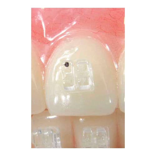 Brack F5621-12 Ghiaccio Roth Zafiro .022" Nº30